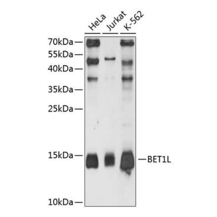 Western Blot - Anti-BET1L Antibody (A80912) - Antibodies.com