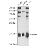 Western Blot - Anti-BET1L Antibody (A80912) - Antibodies.com