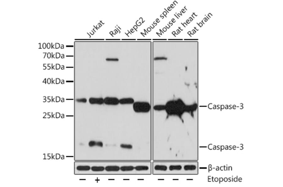 Western Blot - Anti-Caspase-3 Antibody (A80913) - Antibodies.com