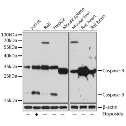 Western Blot - Anti-Caspase-3 Antibody (A80913) - Antibodies.com