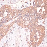 Immunohistochemistry - Anti-Caspase-3 Antibody (A80913) - Antibodies.com