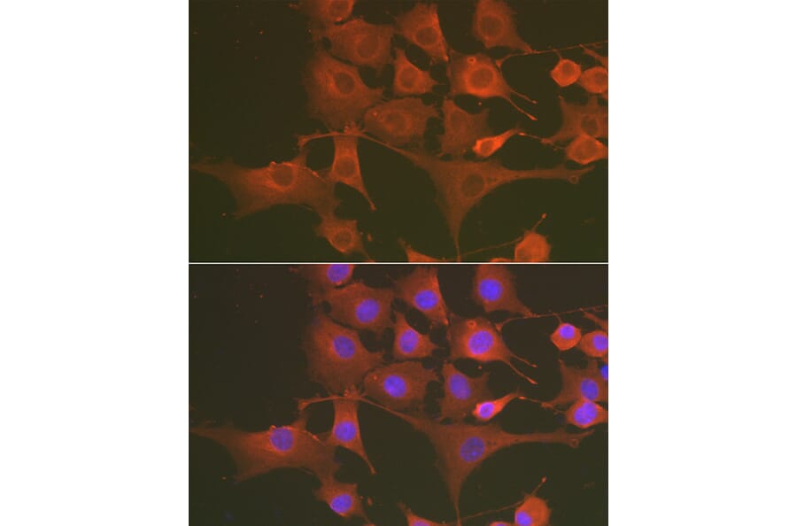 Immunofluorescence - Anti-Caspase-3 Antibody (A80913) - Antibodies.com