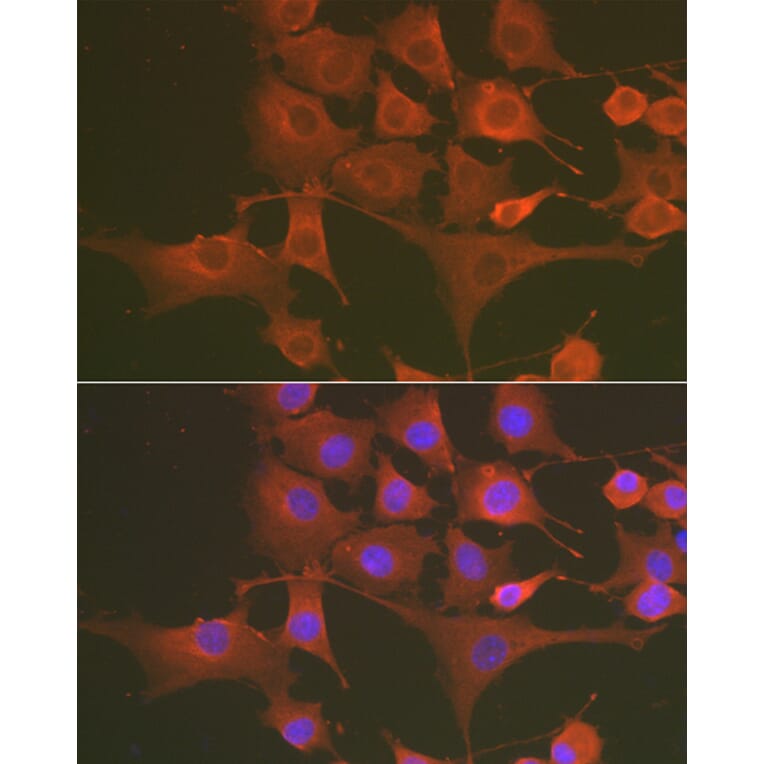 Immunofluorescence - Anti-Caspase-3 Antibody (A80913) - Antibodies.com