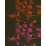 Immunofluorescence - Anti-Caspase-3 Antibody (A80913) - Antibodies.com