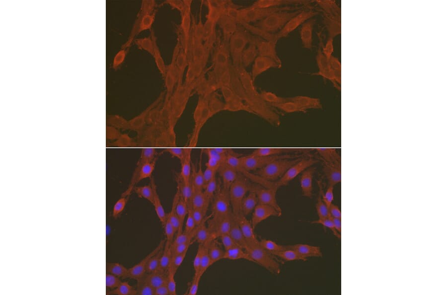 Immunofluorescence - Anti-Caspase-3 Antibody (A80913) - Antibodies.com