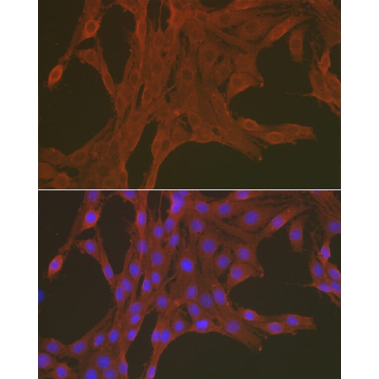 Immunofluorescence - Anti-Caspase-3 Antibody (A80913) - Antibodies.com