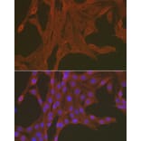 Immunofluorescence - Anti-Caspase-3 Antibody (A80913) - Antibodies.com