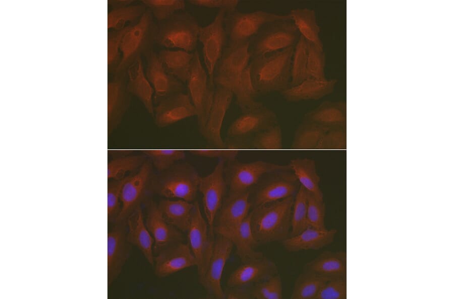 Immunofluorescence - Anti-Caspase-3 Antibody (A80913) - Antibodies.com