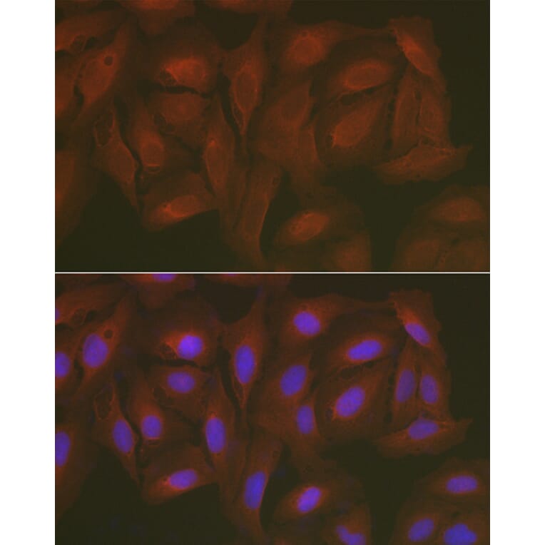 Immunofluorescence - Anti-Caspase-3 Antibody (A80913) - Antibodies.com