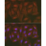 Immunofluorescence - Anti-Caspase-3 Antibody (A80913) - Antibodies.com