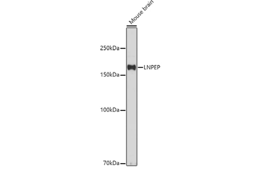 Western Blot - Anti-LNPEP Antibody (A80914) - Antibodies.com