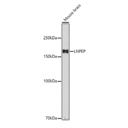 Western Blot - Anti-LNPEP Antibody (A80914) - Antibodies.com