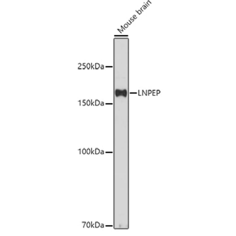 Western Blot - Anti-LNPEP Antibody (A80914) - Antibodies.com