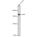 Western Blot - Anti-LNPEP Antibody (A80914) - Antibodies.com