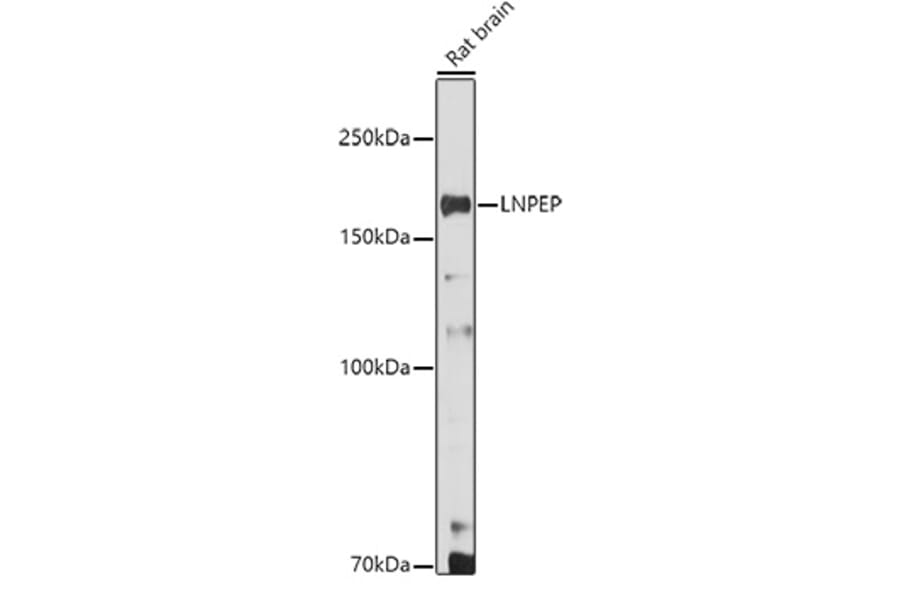 Western Blot - Anti-LNPEP Antibody (A80914) - Antibodies.com