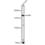 Western Blot - Anti-LNPEP Antibody (A80914) - Antibodies.com