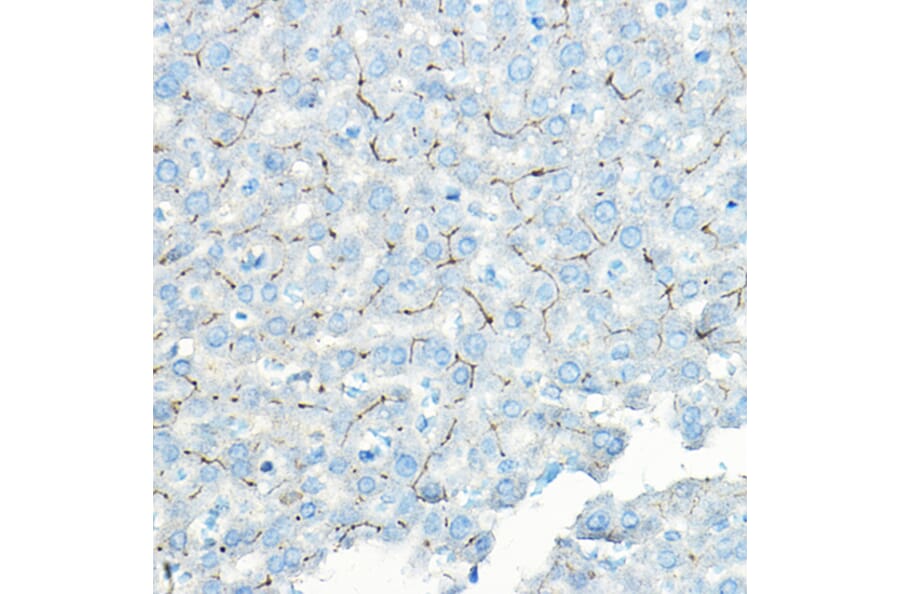 Immunohistochemistry - Anti-LNPEP Antibody (A80914) - Antibodies.com