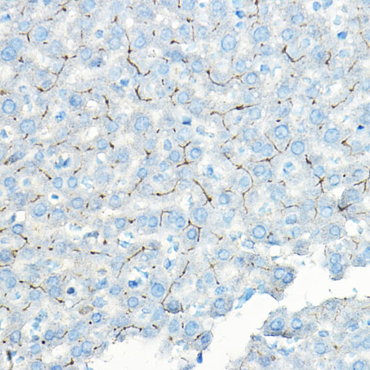 Immunohistochemistry - Anti-LNPEP Antibody (A80914) - Antibodies.com