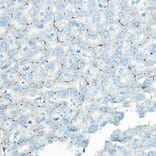 Immunohistochemistry - Anti-LNPEP Antibody (A80914) - Antibodies.com