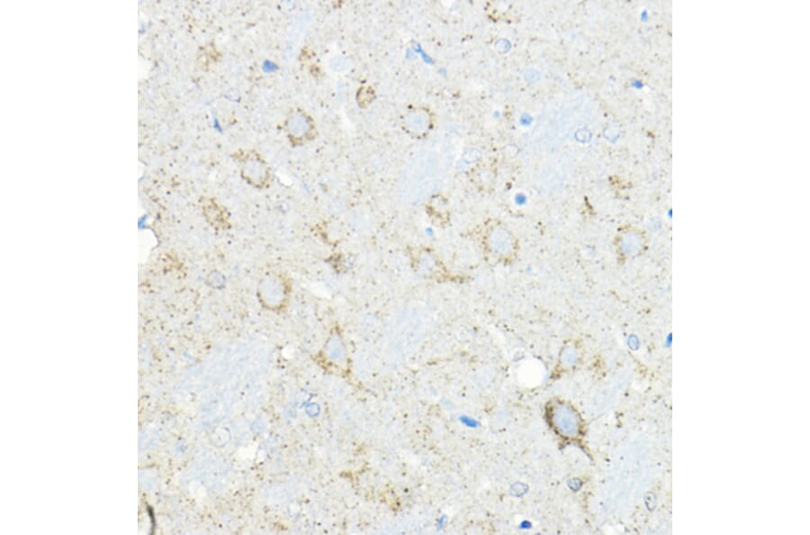 Immunohistochemistry - Anti-LNPEP Antibody (A80914) - Antibodies.com