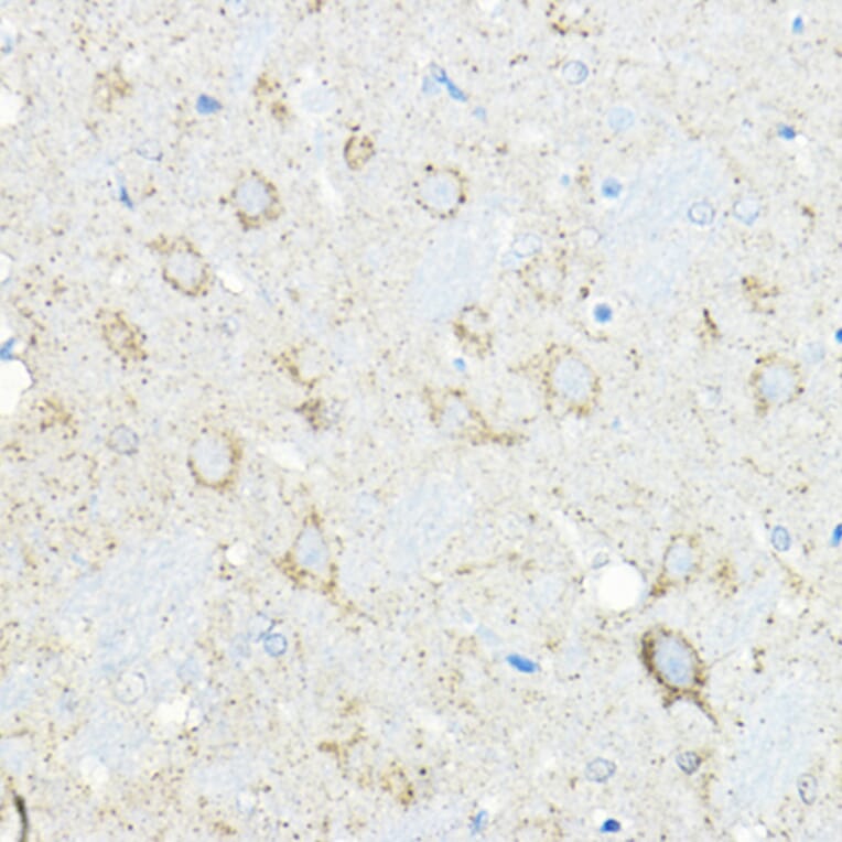 Immunohistochemistry - Anti-LNPEP Antibody (A80914) - Antibodies.com