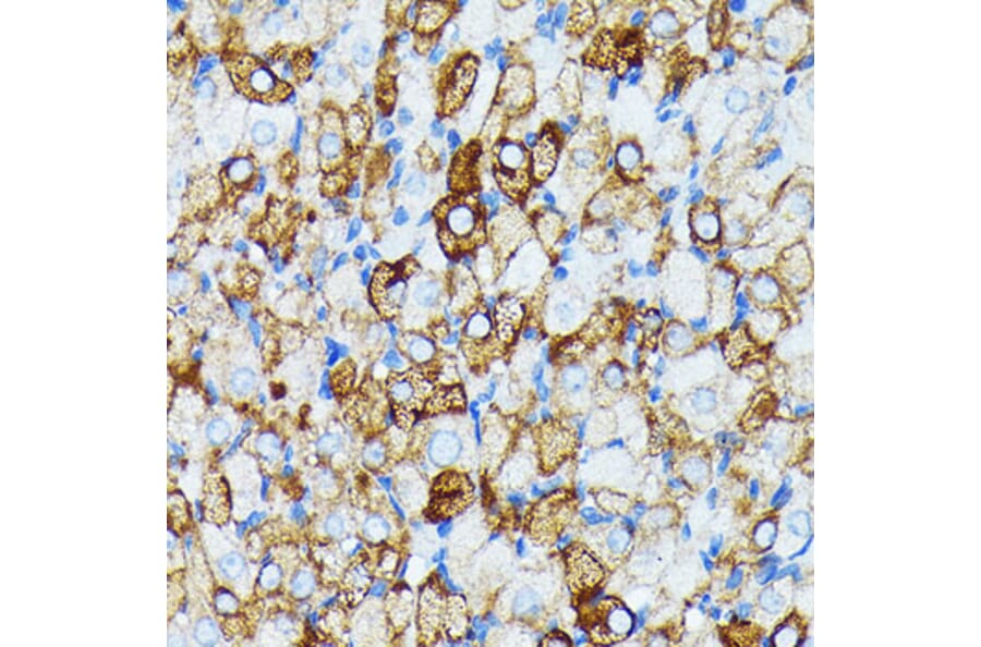 Immunohistochemistry - Anti-JAK1 Antibody [ARC0434] (A80915) - Antibodies.com