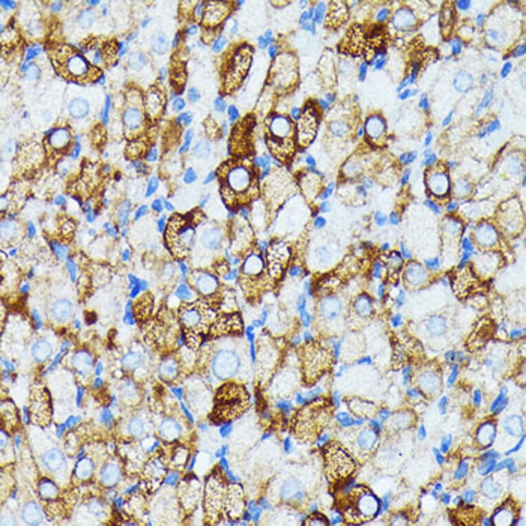 Immunohistochemistry - Anti-JAK1 Antibody [ARC0434] (A80915) - Antibodies.com