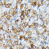 Immunohistochemistry - Anti-JAK1 Antibody [ARC0434] (A80915) - Antibodies.com