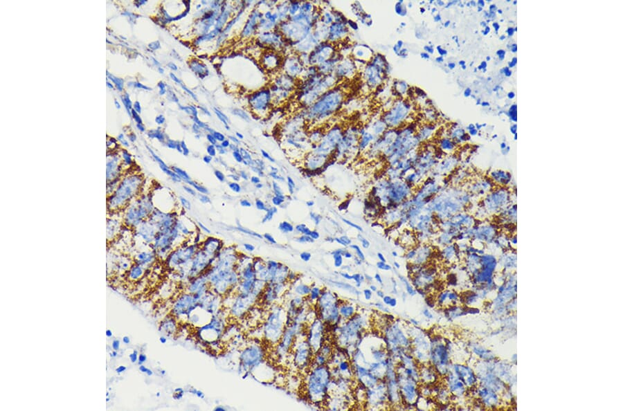 Immunohistochemistry - Anti-JAK1 Antibody [ARC0434] (A80915) - Antibodies.com