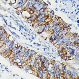 Immunohistochemistry - Anti-JAK1 Antibody [ARC0434] (A80915) - Antibodies.com