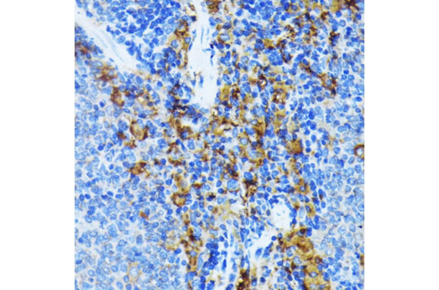 Immunohistochemistry - Anti-JAK1 Antibody [ARC0434] (A80915) - Antibodies.com