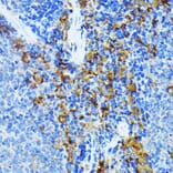 Immunohistochemistry - Anti-JAK1 Antibody [ARC0434] (A80915) - Antibodies.com