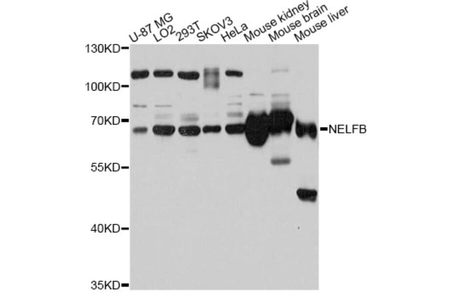 Western Blot - Anti-NELFB Antibody (A12023) - Antibodies.com
