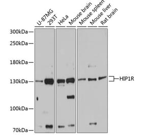 Western Blot - Anti-HIP1R Antibody (A80917) - Antibodies.com