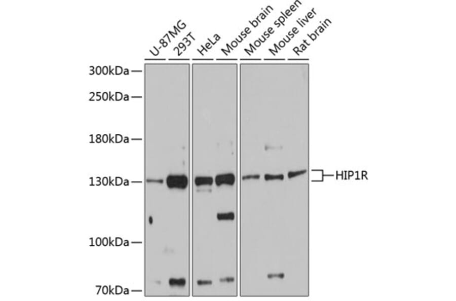 Western Blot - Anti-HIP1R Antibody (A80917) - Antibodies.com