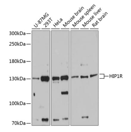 Western Blot - Anti-HIP1R Antibody (A80917) - Antibodies.com
