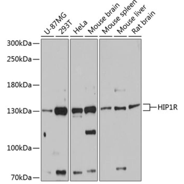 Western Blot - Anti-HIP1R Antibody (A80917) - Antibodies.com