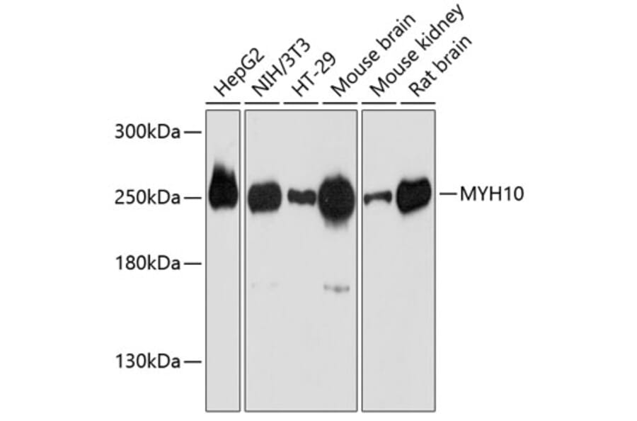 Western Blot - Anti-non-muscle Myosin IIB/MYH10 Antibody (A80918) - Antibodies.com