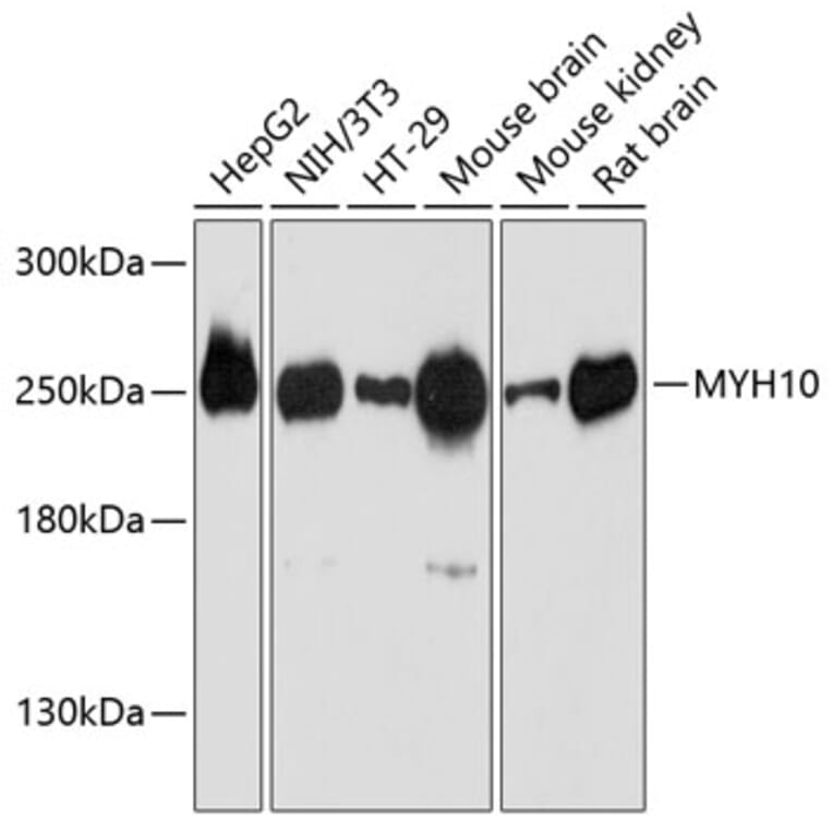 Western Blot - Anti-non-muscle Myosin IIB/MYH10 Antibody (A80918) - Antibodies.com