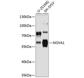 Western Blot - Anti-Nova1 Antibody (A80919) - Antibodies.com