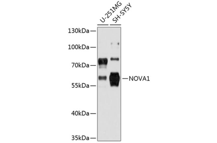 Western Blot - Anti-Nova1 Antibody (A80919) - Antibodies.com