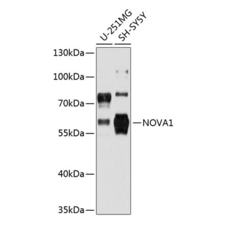 Western Blot - Anti-Nova1 Antibody (A80919) - Antibodies.com
