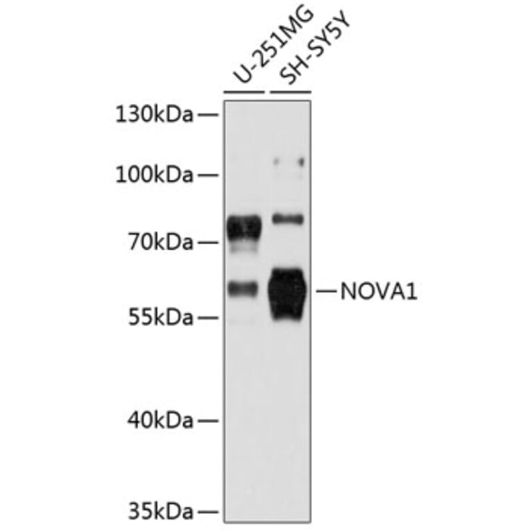 Western Blot - Anti-Nova1 Antibody (A80919) - Antibodies.com