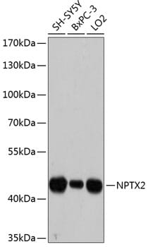 Western blot analysis of extracts of various cell lines, using Anti-NPTX2 Antibody (A12031) at 1:3000 dilution.
Secondary antibody: Goat Anti-Rabbit IgG (H+L) (HRP) (AS014) at 1:10,000 dilution.
Lysates / proteins: 25µg per lane.
Blocking buffer: 3% non-fat dry milk in TBST.
Detection: ECL Basic Kit (RM00020).
Exposure time: 60s.