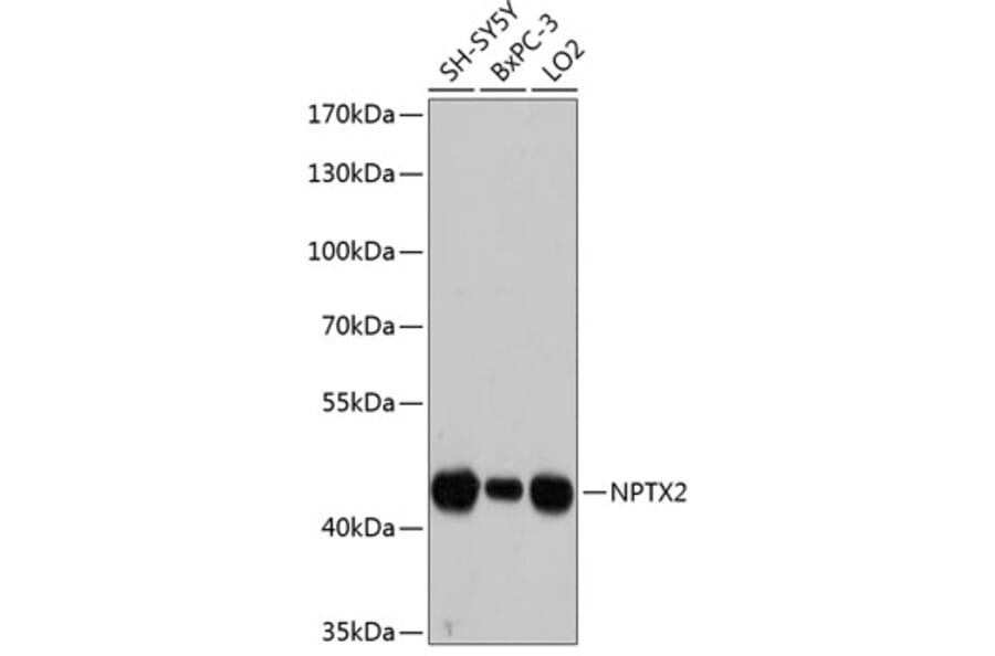 Western Blot - Anti-NPTX2 Antibody (A80920) - Antibodies.com
