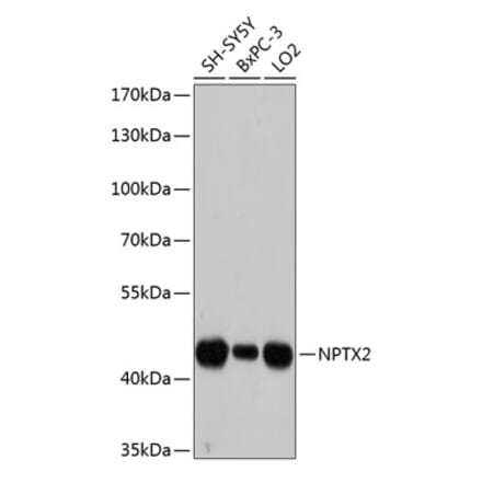 Western Blot - Anti-NPTX2 Antibody (A80920) - Antibodies.com