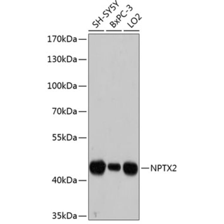 Western Blot - Anti-NPTX2 Antibody (A80920) - Antibodies.com