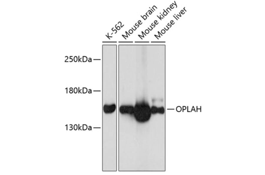 Western Blot - Anti-OPLAH Antibody (A80921) - Antibodies.com