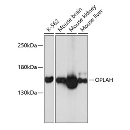 Western Blot - Anti-OPLAH Antibody (A80921) - Antibodies.com