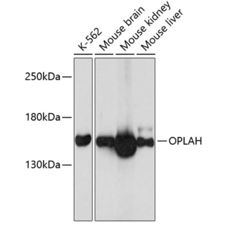Western Blot - Anti-OPLAH Antibody (A80921) - Antibodies.com